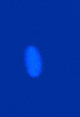 ZnS(Ag) @ 50 keV X-ray digitally contrast enhanced