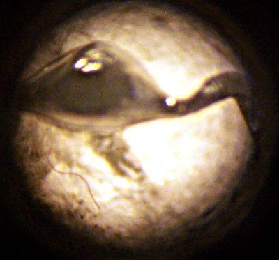 Microscope pic